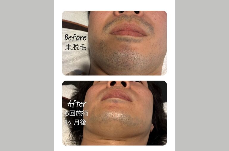 matsumoto-mens-datsumo-salon.