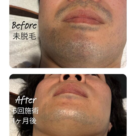 matsumoto-mens-datsumo-salon.